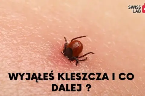 Jak sprawdzić, czy kleszcz wyszedł cały? Praktyczny poradnik