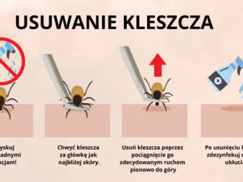 Nimfa kleszcza: jak usunąć bezpiecznie? Instrukcja krok po kroku